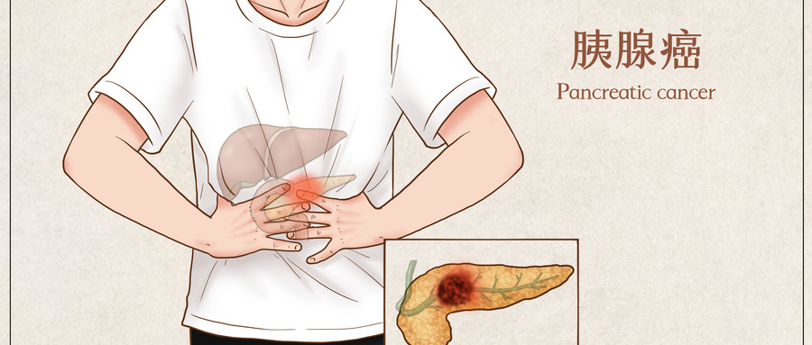 胰腺癌患者总腹胀、吃不下？3 个饮食小技巧，帮你减轻消化负担！