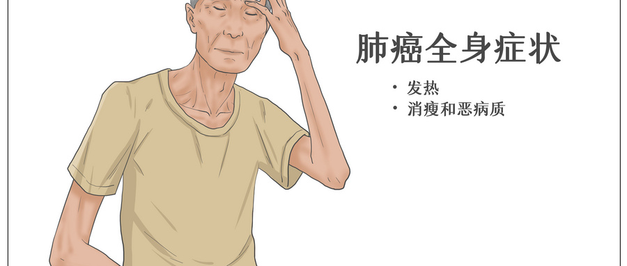 摄图网_401802923_wx_肺癌全身症状医疗插画(企业商用) (1).jpg